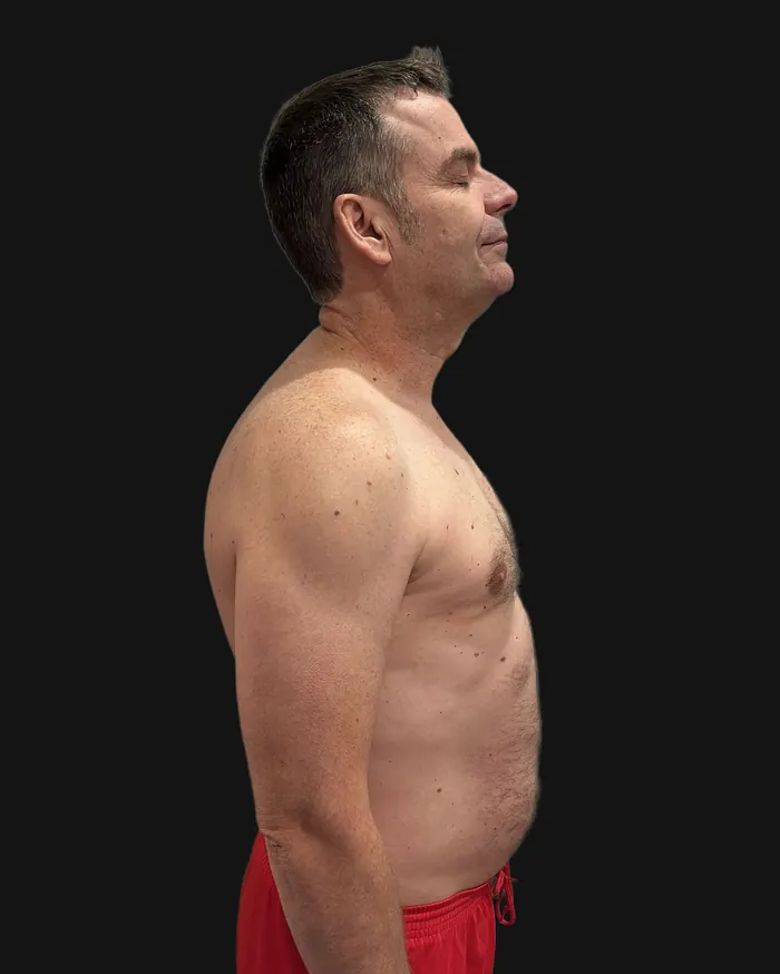 Alberto después